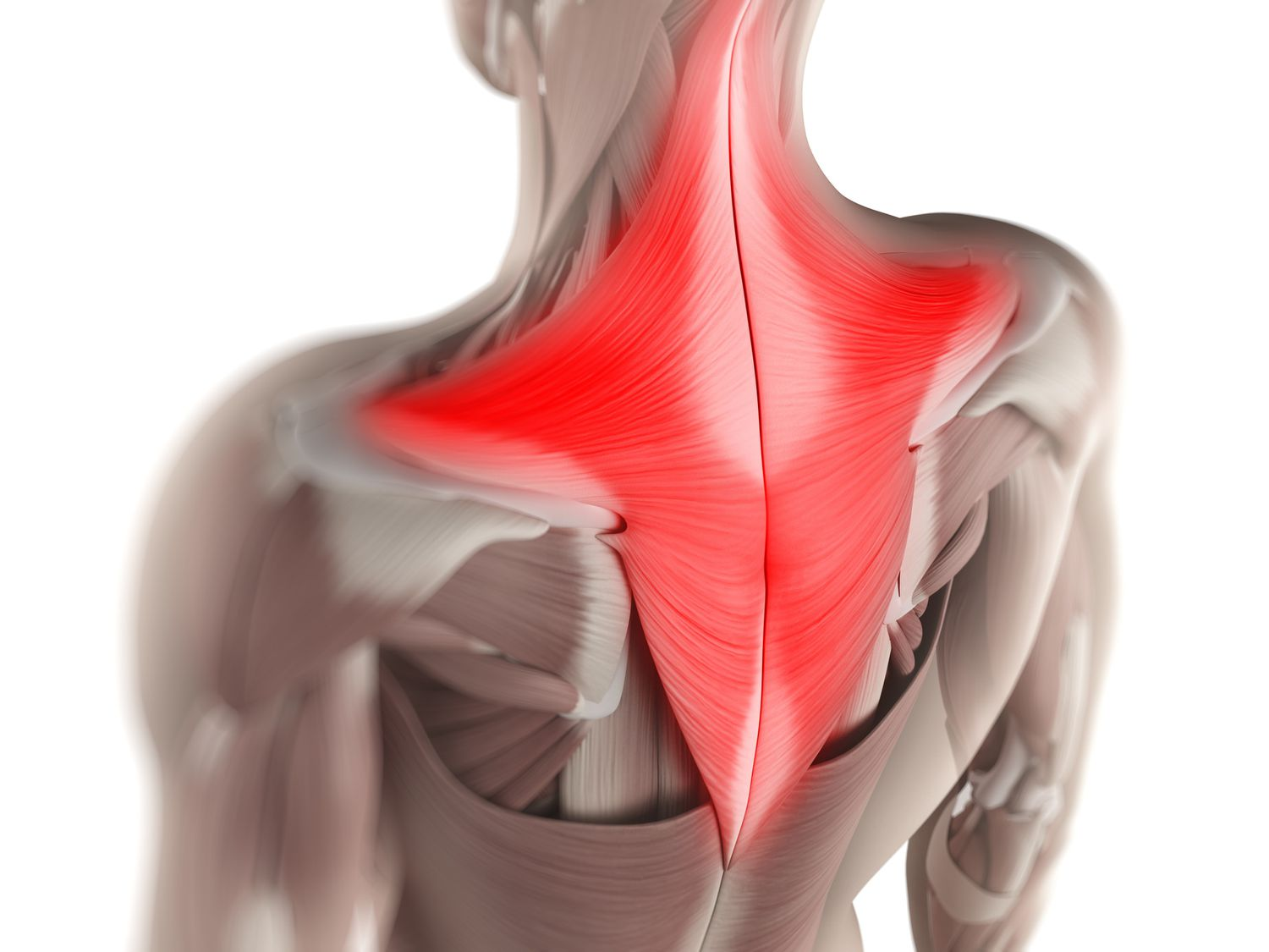 Understanding Trapezitis or Trapezius Muscle Strain : Causes, Symptoms, and Treatment