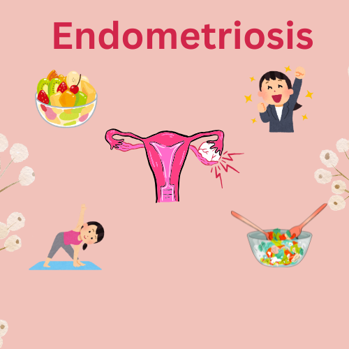 Endometriosis Explained: Everything You Need to Know